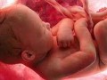 ۱۷ رفتار عجیب و غریب اما جالب جنین در شکم مادر