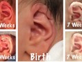 Lop ear یا گوش آویخته در نوزادان چیست؟