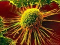 M.A.Z - ژن سرطان کشف شد( خبر فوری)
