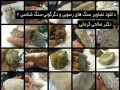 معدن کاران - دانلود تصاویر تمامی سنگ های رسوبی و دگرگونی سنگ شناسی ۲
