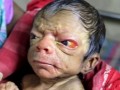 نوزادی که ۸۰ ساله به دنیا آمد!تصاویر - روژان