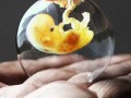 راههای جلوگیری از سقط جنین ، ۸ روش - سلامت بانوان اوما