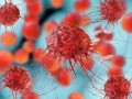 آنالیز DNA؛ هشداری زودهنگام برای سرطان سینه - روژان