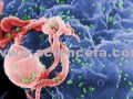 با پیوند مغز استخوان HIV نابودی ویروس - sciencefa.com
