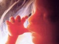 تعیین جنسیت جنین باتشخیص ژنتیکی قبل از کاشت رحم | انجمن علمی میکروبیولوژی