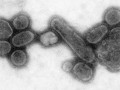شیوع همگانی آنفولانزای اسپانیایی | یک نفر