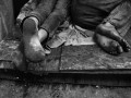 مقاله ای کامل در مورد تاثیر فقر بر بهداشت