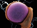 مقاله ای کامل در مورد سلول های بنیادی سرطان | پژوهشکده