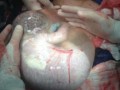 تصویری نادر از تولد یک نوزاد درون کیسه آب - خبرخوان هوشمند ایرانستان