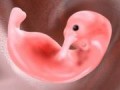 سقط جنین - پارسه گرد
