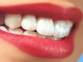 چگونه با پوست پرتقال دندانی سفید داشته باشیم