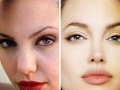 آنجلينا جولي قبل و بعد از جراحي پلاستيک صورت +عکس