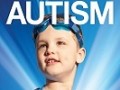بیماری اوتیسم چیست؟ ( علايم )