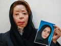 ایران: ٢٠ مورد در  ١٠ سال؛ انگلستان: ١٠٤ مورد در ٢ سال غربی ها چقدر اسید  می  پاشند؟