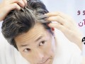 علل سفیدی مو و راههای درمان سفیدی زودرس | وب سایت تخصصی پوست و مو
