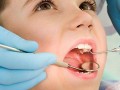 کنترل عفونت در مراکز دندانپزشکی جدی گرفته شود