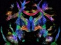 تکنیک مشاهده تغییرات زیستی مغز از آغاز تشکیل نطفه | نیکو
