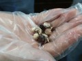 درمان سنگ کیسه صفرا با گیاه درمانی - مجله اينترنتي وبگفتار