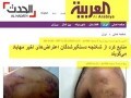 العربیه عربستان از تصویر شکنجه مردم بحرین به عنوان شکنجه در مهاباداستفاده کرد!! عکس