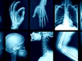 پردازش تصاویر پزشکی | الکترونیک پروژه سایت تخصصی برق