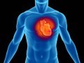 حمله قلبی - دکتر محمد حسین نجفی | متخصص قلب و عروق