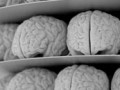 آیا ضریب هوشی با اندازه مغز نسبت مستقیم دارد؟