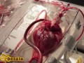 قلب در یک جعبه.پیوند قلب با تکنولوژی جدید پزشکی - فیلم