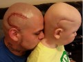 حرکت زیبای پدری که جای زخم تومور سرطانی پسرش را روی سر خود خالکوبی کرده است - روژان