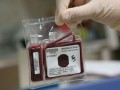 فواید عضویت در بانک خون بند ناف
