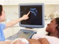 اولتراسوند یا سونوگرافی در بارداری
