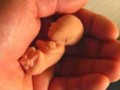 سقط جنين چيست؟