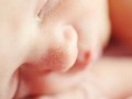با ضایعات پوستی در نوزادان چه کنیم؟ آیا این تغییرات پوستی خطرناک اند؟