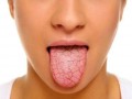 خشکی دهان / علل، علائم، عوارض و روشهای درمان خانگی