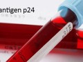 آزمایش آنتی ژن سطحی p٢٤