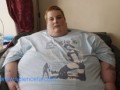واكسن ضد چاقی در راه است - sciencefa.com