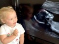 تماشا کنید: عکس‌العمل تامل برانگیز کودک ۲ ساله به سونوگرافی خواهرش در شکم مادر - روژان