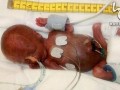 کوچک‌ترین نوزاد متولد شده تاریخ/عکس