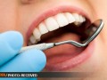 پوسیدگی دندان شایع‌ترین بیماری جهان است  | پایگاه خبری پویانا
