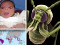 گسترش ویروس علاج ناپذیری که باعث کوچک شدن سر نوزادان می‌شود