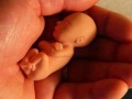 چه مادرانی سقط جنین می‌کنند؟