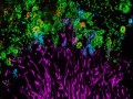 ثبت تصاویر رنگارنگ از میکروب‌های دندان با روش جدید تصویربرداری - روژان