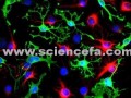 سلول‌ بنیادی مرتبط با خلاقیت مغز شناخته شد - sciencefa.com