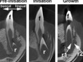 سلول‌های بنیادی تمساح سرنخ‌هایی برای رویش دوباره‌ی دندان‌ها در انسان به‌ دست می‌دهد